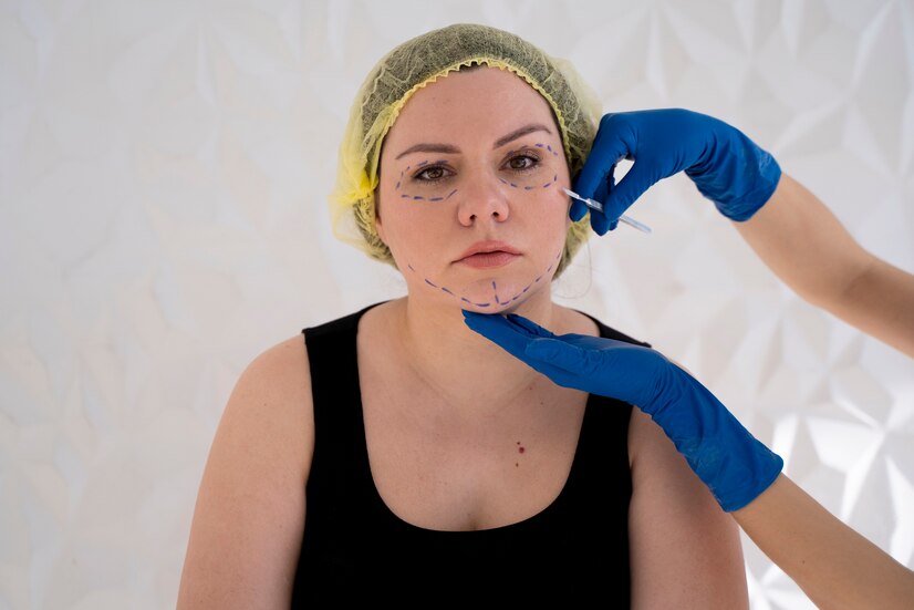 Kırışıklık Tedavisi Nedir?