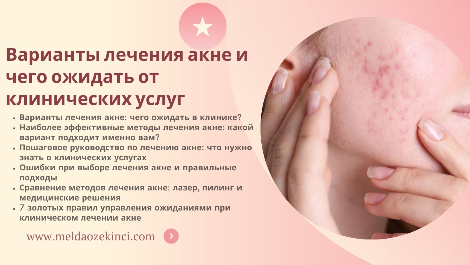 Варианты лечения акне и чего ожидать от клинических услуг