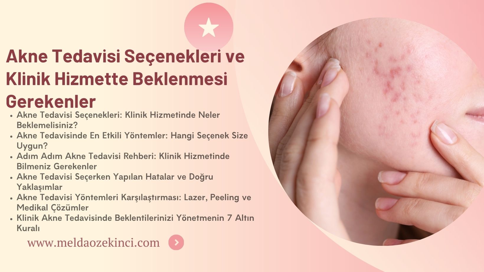 Akne Tedavisi Seçenekleri ve Klinik Hizmette Beklenmesi Gerekenler