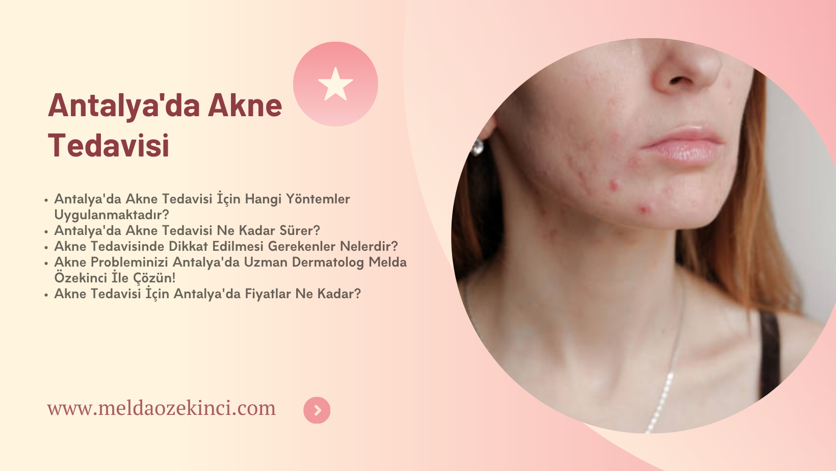 Antalya'da Akne Tedavisi