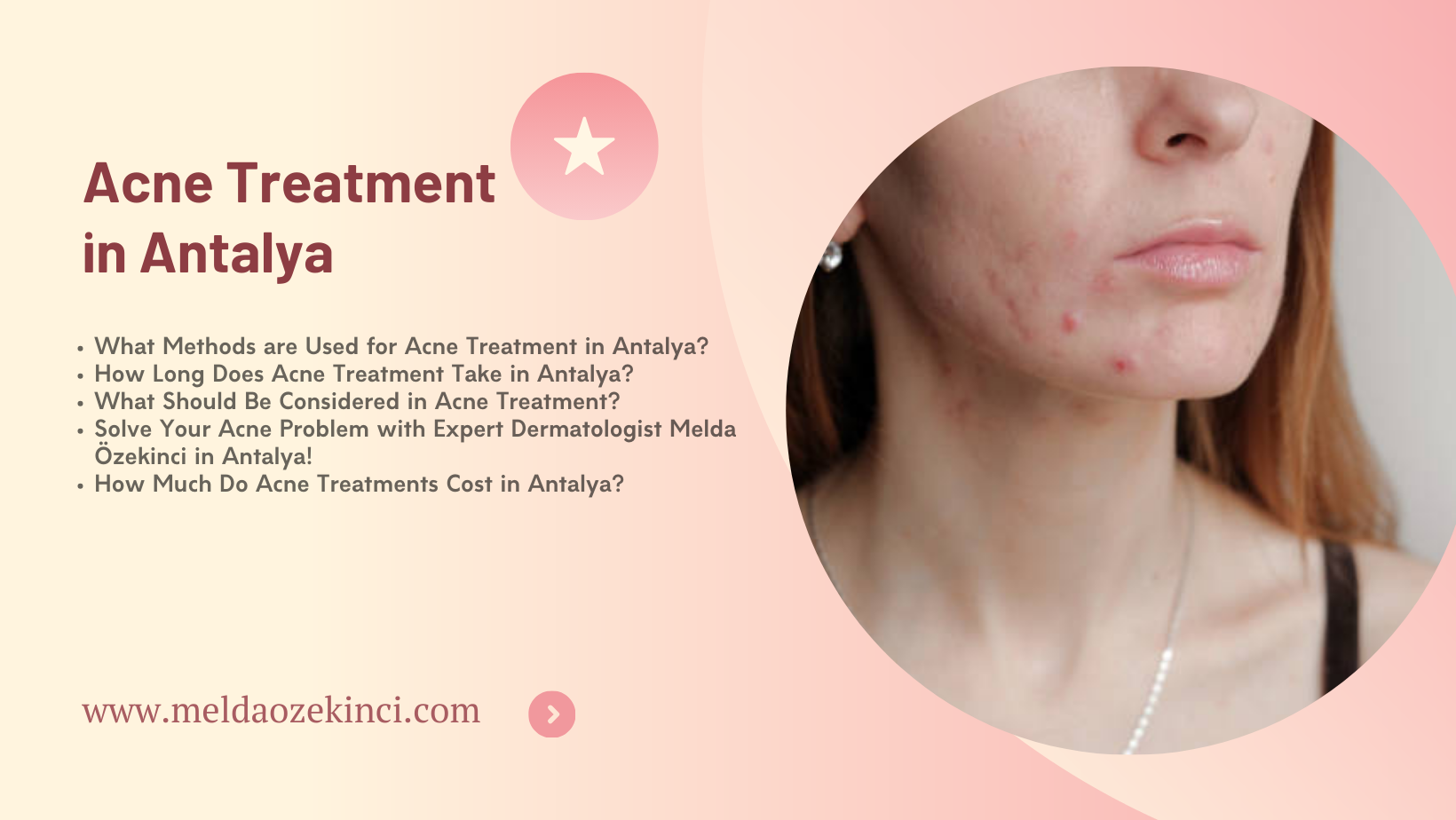 Acne Treatment in Antalya