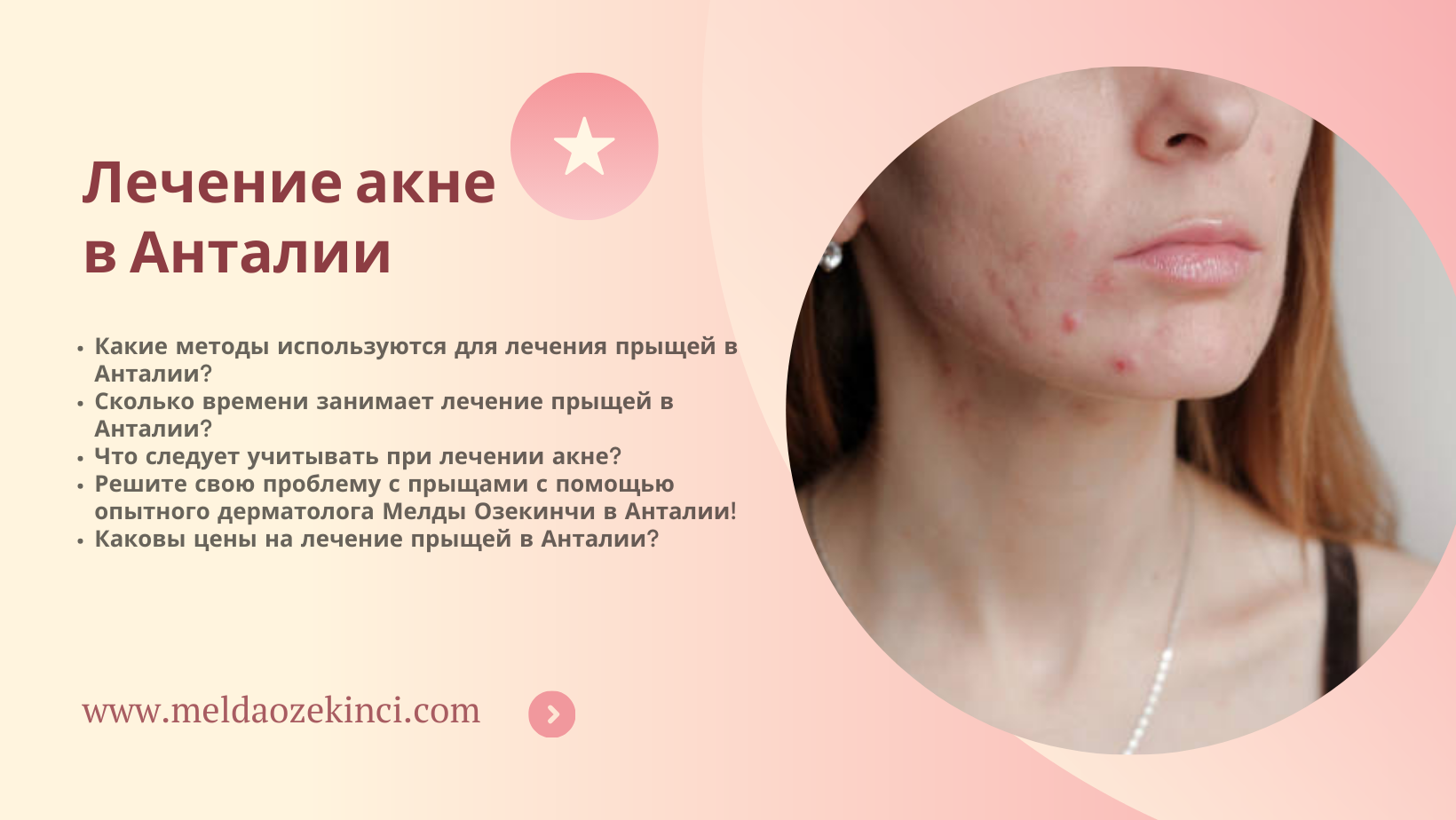 Лечение акне в Анталии