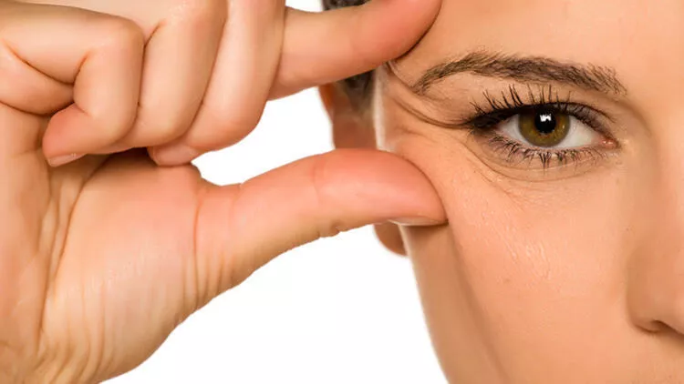 Cilt Kırışıklığı Cilt Kırışıklığı