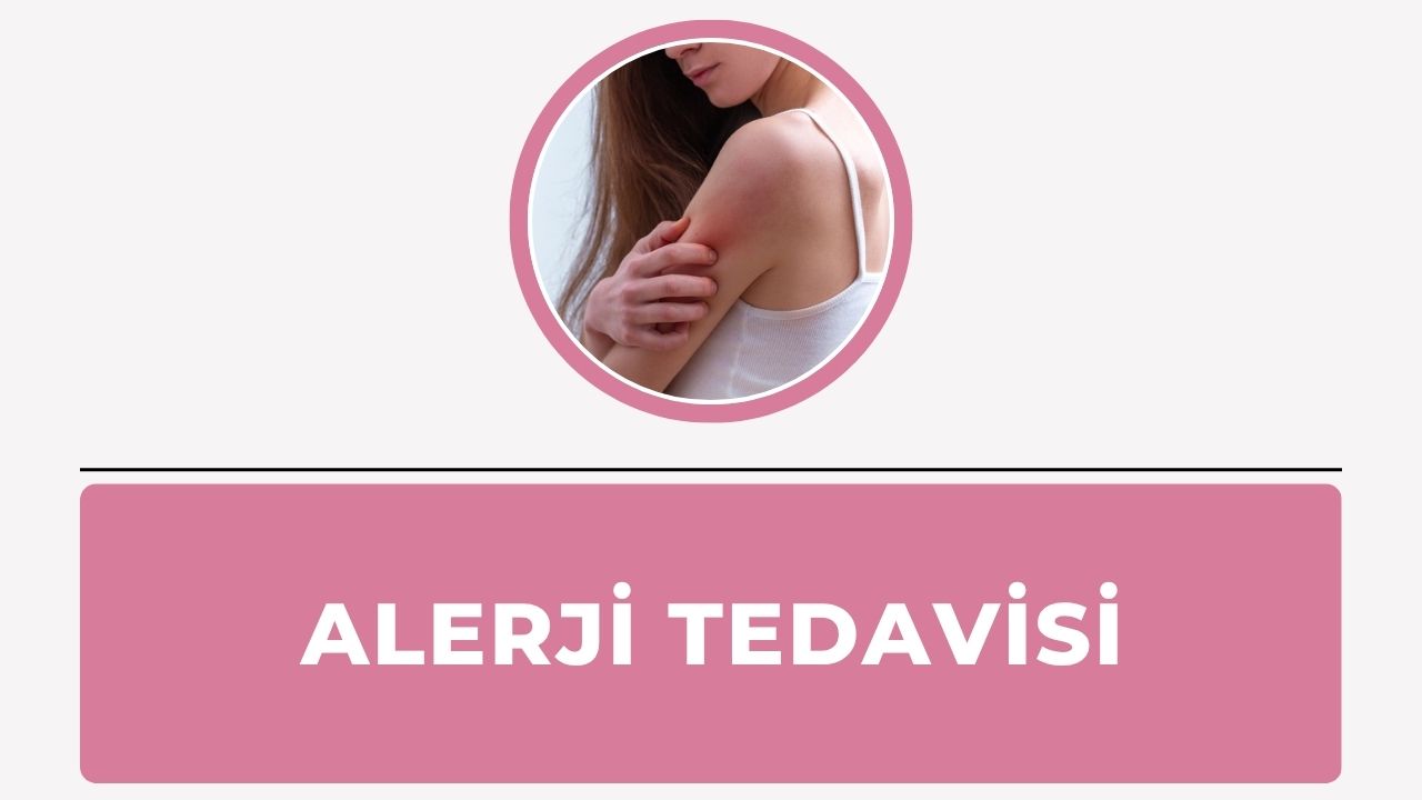 Alerji Tedavisi