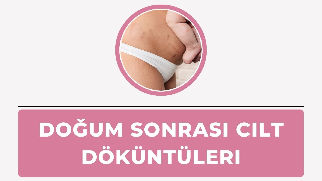 Doğum Sonrası Cilt Döküntüleri