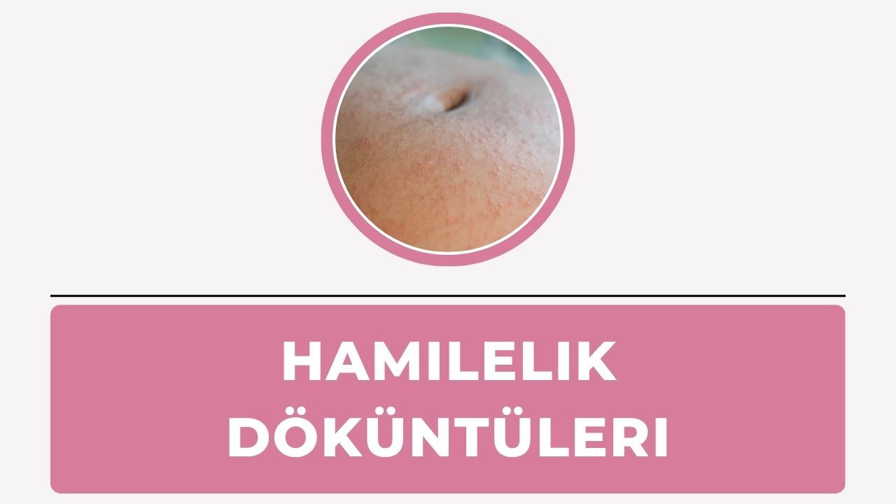 Hamilelik Döküntüleri
