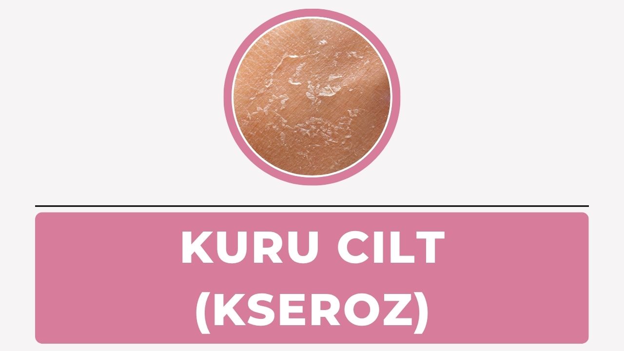 Kuru Cilt