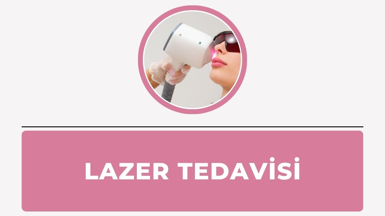 Lazer Tedavisi
