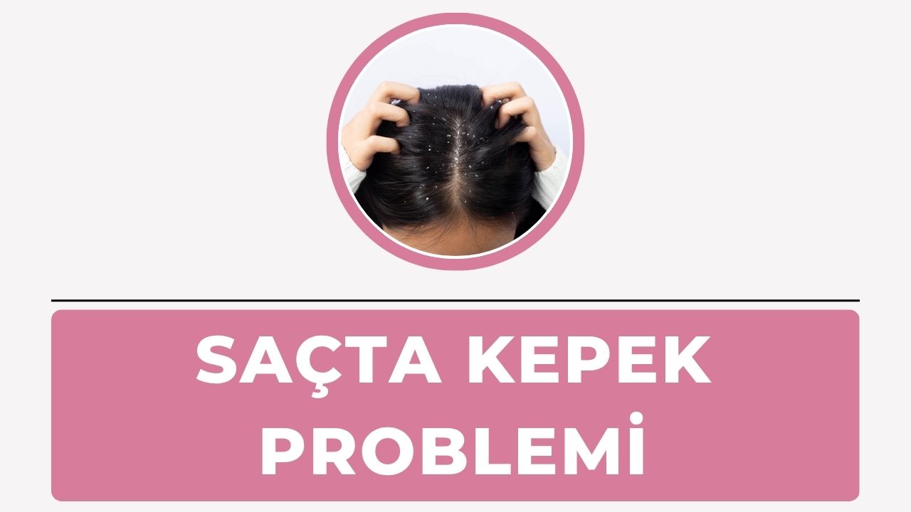 Saçta Kepek Problemi