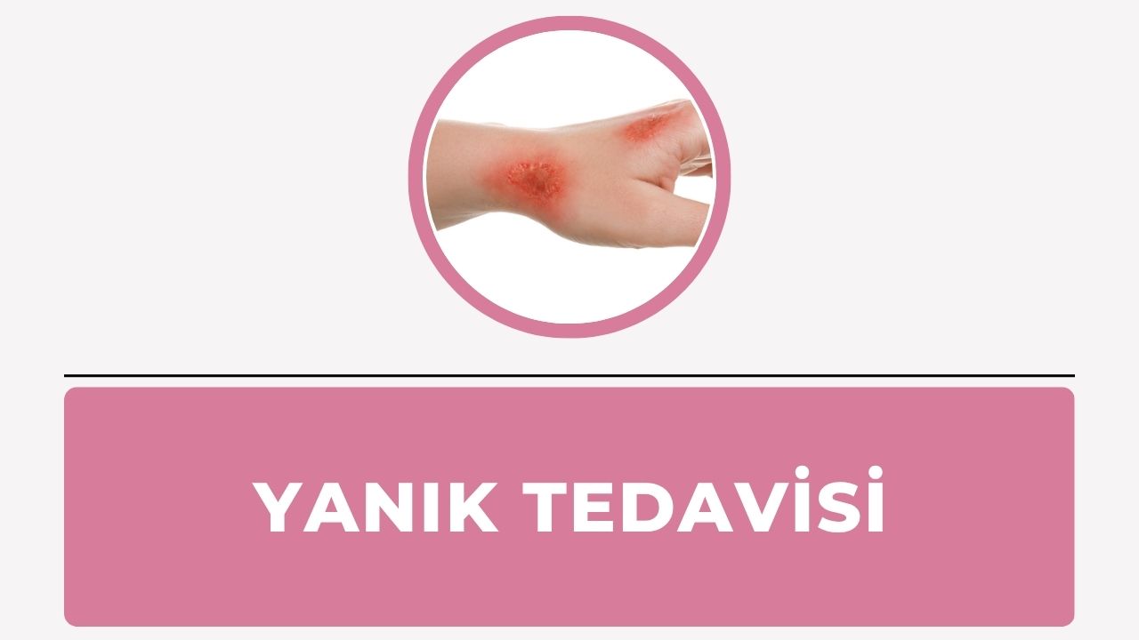 Yanık Tedavisi
